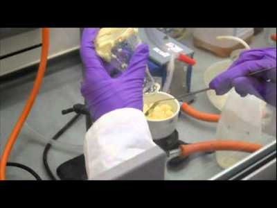 SINTESI DEL DIBENZALACETONE